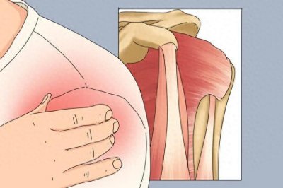 ​肩周炎的痛三点图